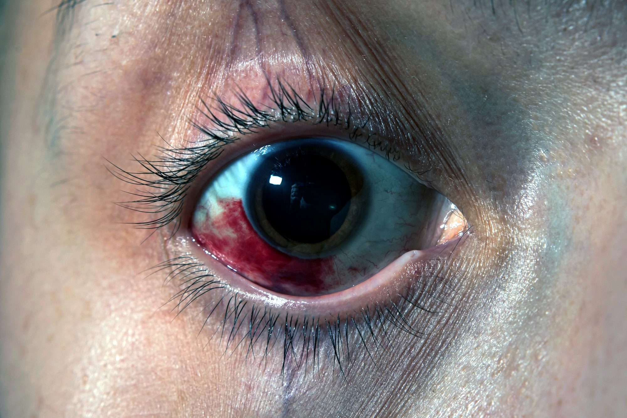 workplace eye injury background